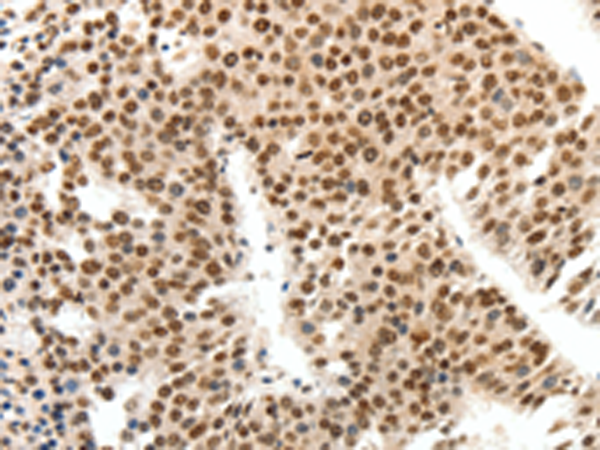 Rabbit Polyclonal Antibody to SIPA1