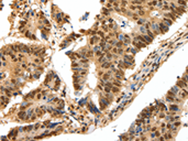 Rabbit Polyclonal Antibody to SSB