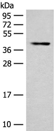 Rabbit Polyclonal Antibody to SSTR2