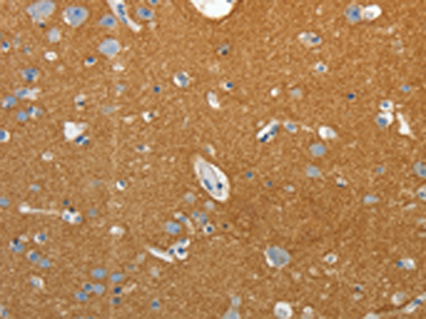 Rabbit Polyclonal Antibody to SSTR4