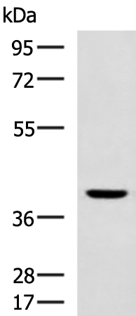 Rabbit Polyclonal Antibody to SSTR5