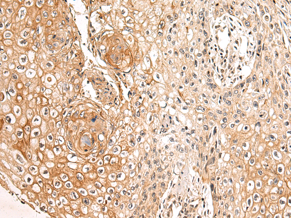 Rabbit Polyclonal Antibody to STRA6