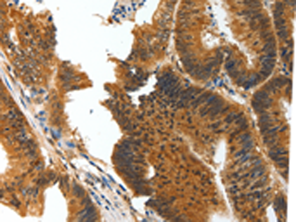 Rabbit Polyclonal Antibody to BIRC6