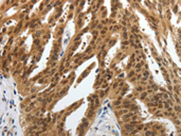 Rabbit Polyclonal Antibody to SUMO1
