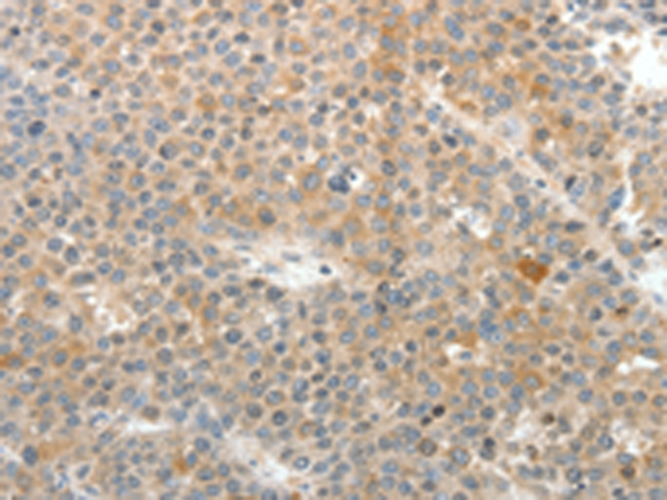 Rabbit Polyclonal Antibody to SV2A