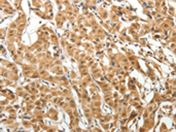 Rabbit Polyclonal Antibody to MAP1A