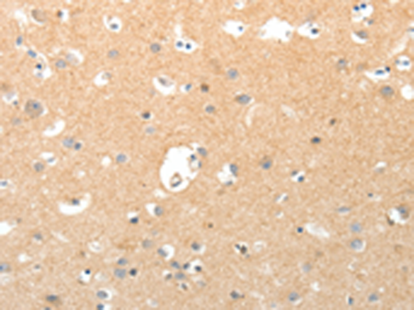 Rabbit Polyclonal Antibody to TNXB