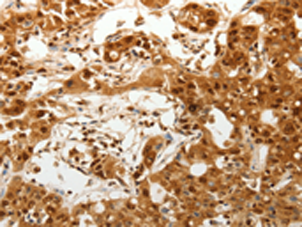 Rabbit Polyclonal Antibody to TENM3