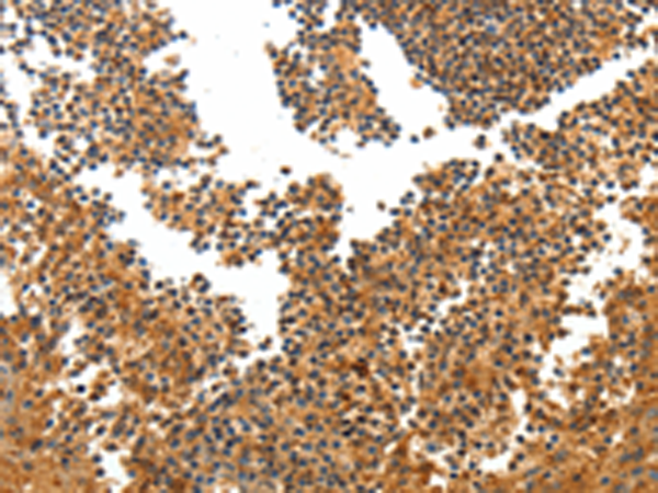 Rabbit Polyclonal Antibody to TERT