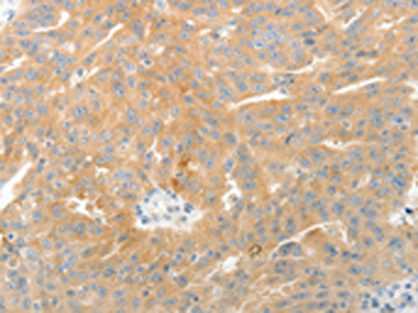 Rabbit Polyclonal Antibody to TEP1