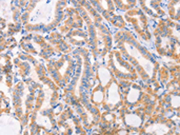 Rabbit Polyclonal Antibody to F13A1