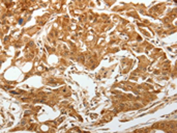 Rabbit Polyclonal Antibody to TGFBR1
