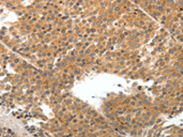 Rabbit Polyclonal Antibody to TEK