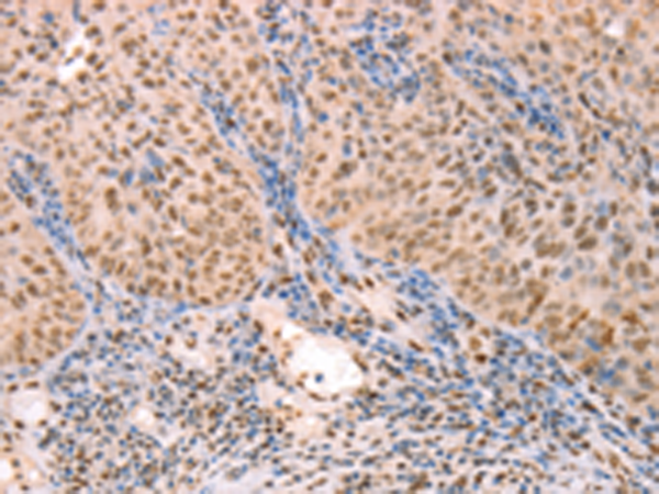 Rabbit Polyclonal Antibody to PTMA