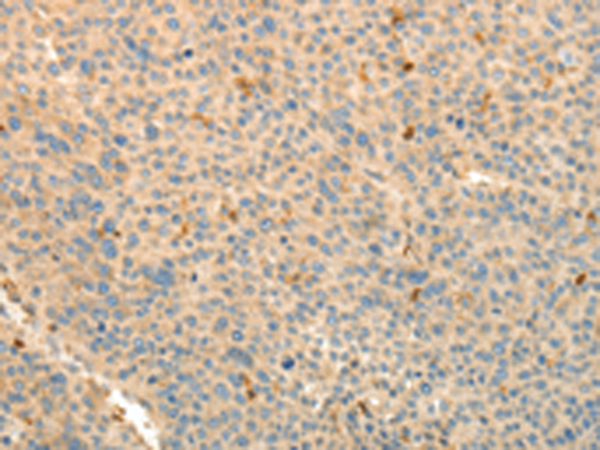 Rabbit Polyclonal Antibody to TMSB4X