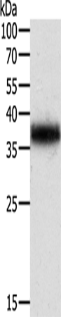 Rabbit Polyclonal Antibody to TPM2