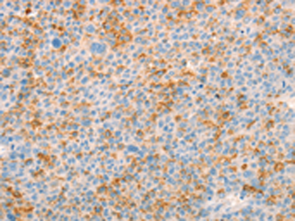 Rabbit Polyclonal Antibody to TRPM7