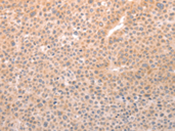 Rabbit Polyclonal Antibody to TRPC3