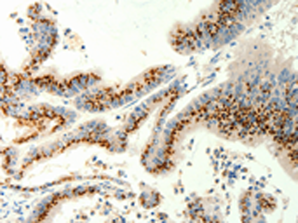 Rabbit Polyclonal Antibody to TRPC6