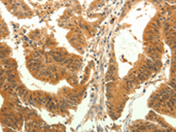 Rabbit Polyclonal Antibody to TRPM7