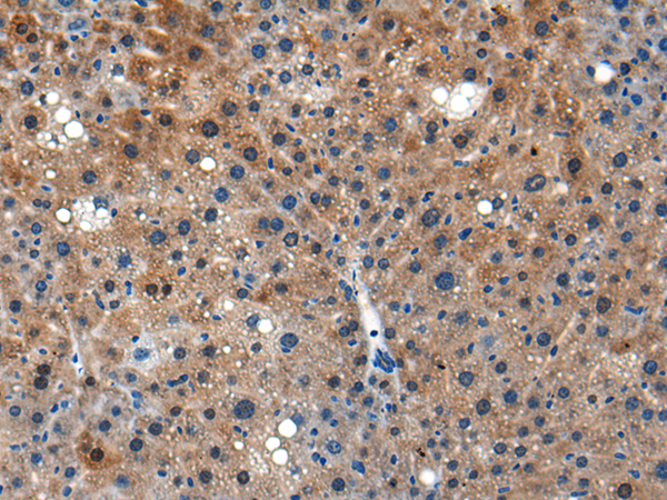 Rabbit Polyclonal Antibody to Ly6a