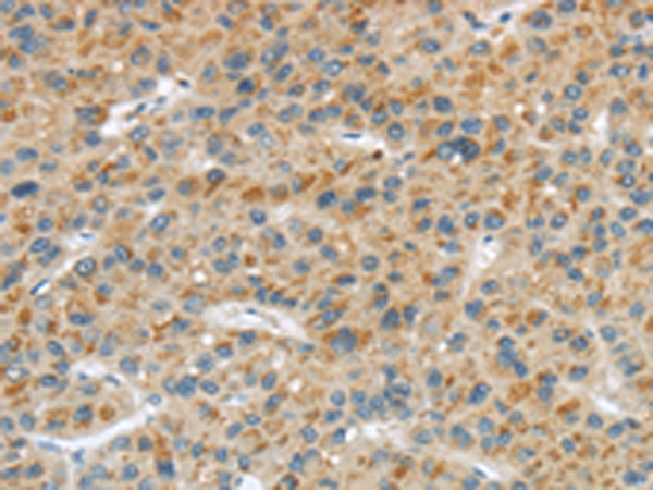 Rabbit Polyclonal Antibody to LPAR1