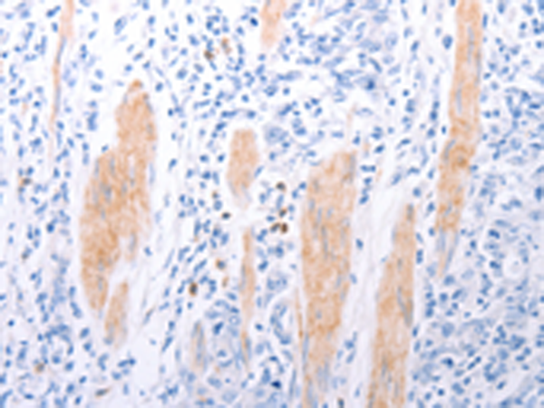 Rabbit Polyclonal Antibody to LPAR2