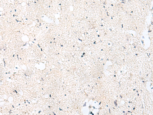 Rabbit Polyclonal Antibody to S1PR5