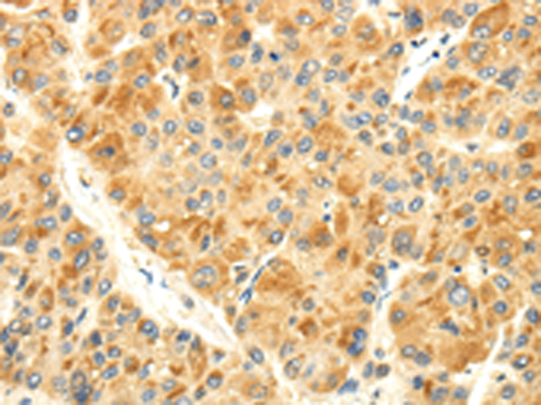 Rabbit Polyclonal Antibody to S1PR2