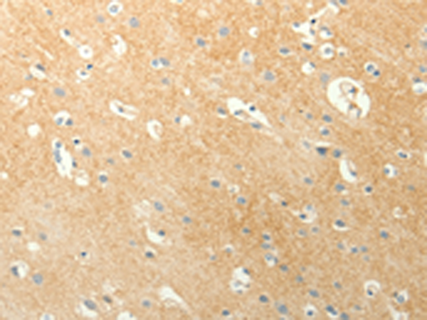Rabbit Polyclonal Antibody to LPAR3