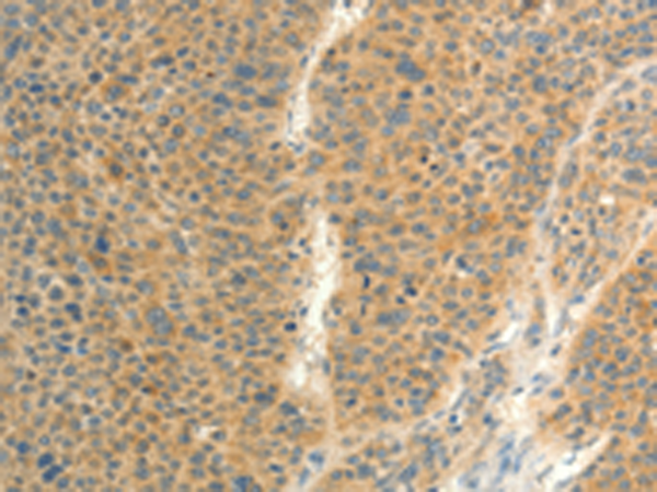 Rabbit Polyclonal Antibody to FAT3