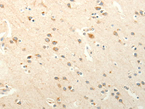 Rabbit Polyclonal Antibody to SMO