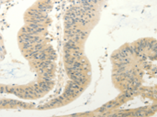 Rabbit Polyclonal Antibody to FZD8