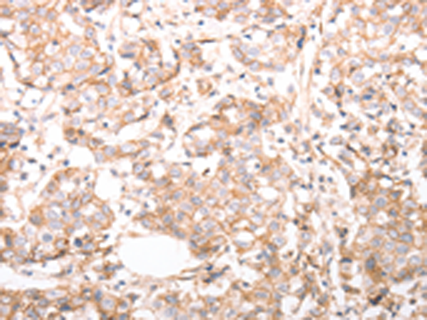 Rabbit Polyclonal Antibody to pan CDH