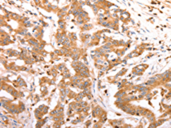 Rabbit Polyclonal Antibody to CELSR2