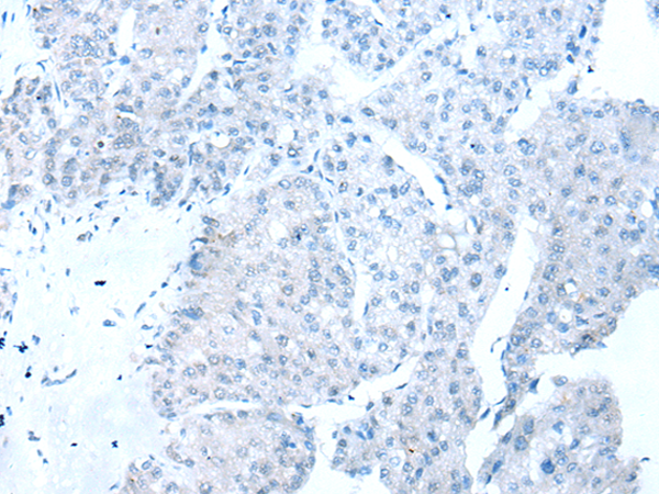 Rabbit Polyclonal Antibody to RBFOX1