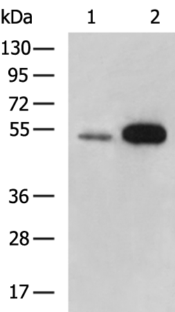 Rabbit Polyclonal Antibody to AADACL4