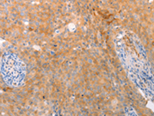 Rabbit Polyclonal Antibody to ABCA2