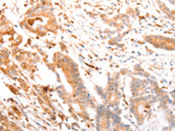 Rabbit Polyclonal Antibody to ABCA4