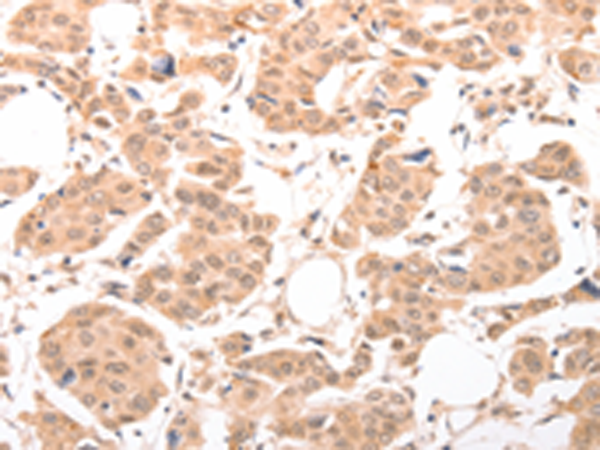 Rabbit Polyclonal Antibody to ACIN1