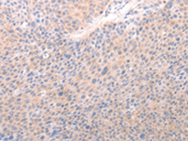 Rabbit Polyclonal Antibody to ACO1