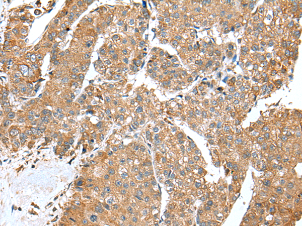 Rabbit Polyclonal Antibody to ACSL3