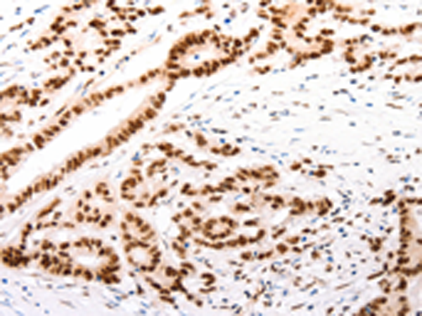 Rabbit Polyclonal Antibody to CASP9 (active)