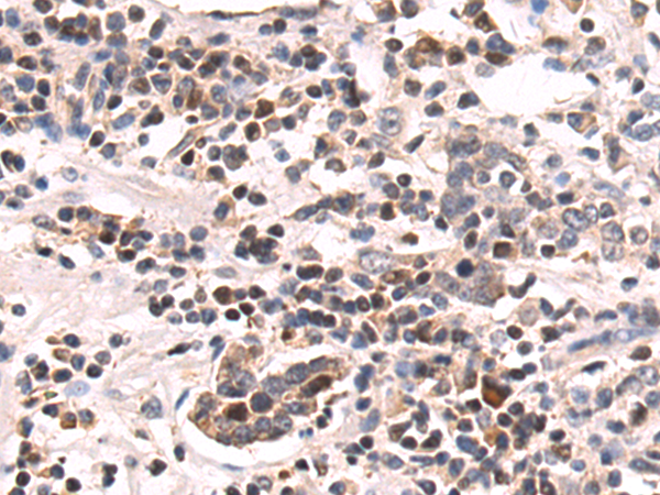 Rabbit Polyclonal Antibody to TADA2A