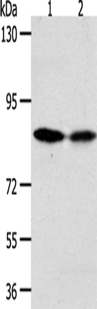 Rabbit Polyclonal Antibody to ADAM11