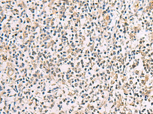 Rabbit Polyclonal Antibody to ADAM12