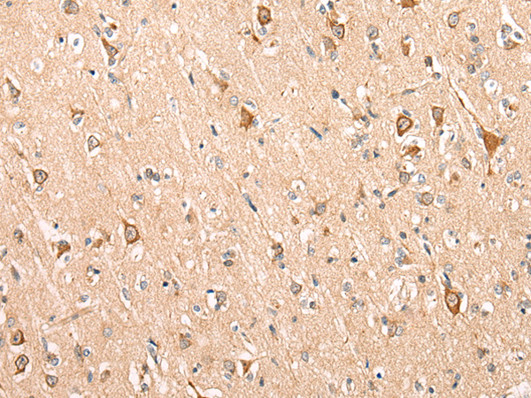 Rabbit Polyclonal Antibody to ADAM19