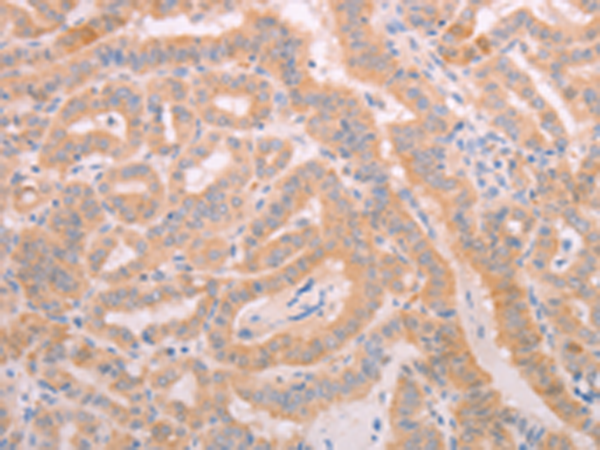 Rabbit Polyclonal Antibody to ADAMTS10