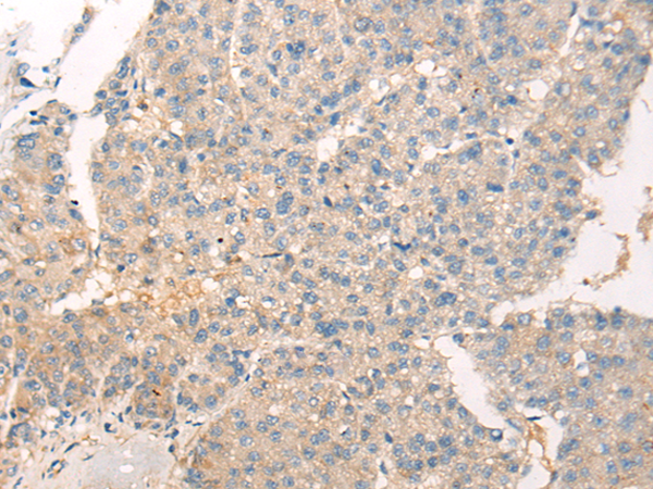Rabbit Polyclonal Antibody to ADAMTS13