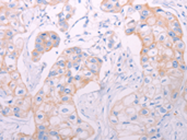 Rabbit Polyclonal Antibody to ADAMTS14
